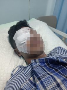 Ironi Pemuda Baubau: Dibacok 10 Orang hingga Buta Total, Kini Malah Jadi Tersangka